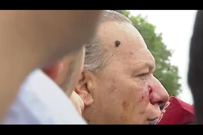 Sergio Berni seguiraacute adelante con la causa por las agresiones de los colectiveros