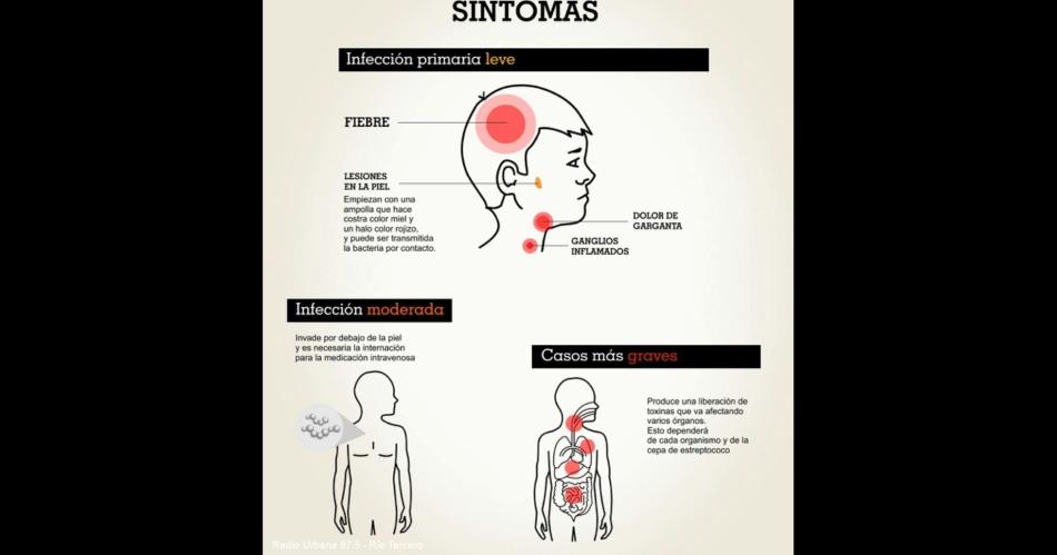 Faringitis- circula una cepa maacutes agresiva en Santiago