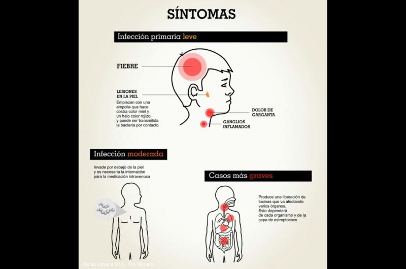 Faringitis- circula una cepa maacutes agresiva en Santiago